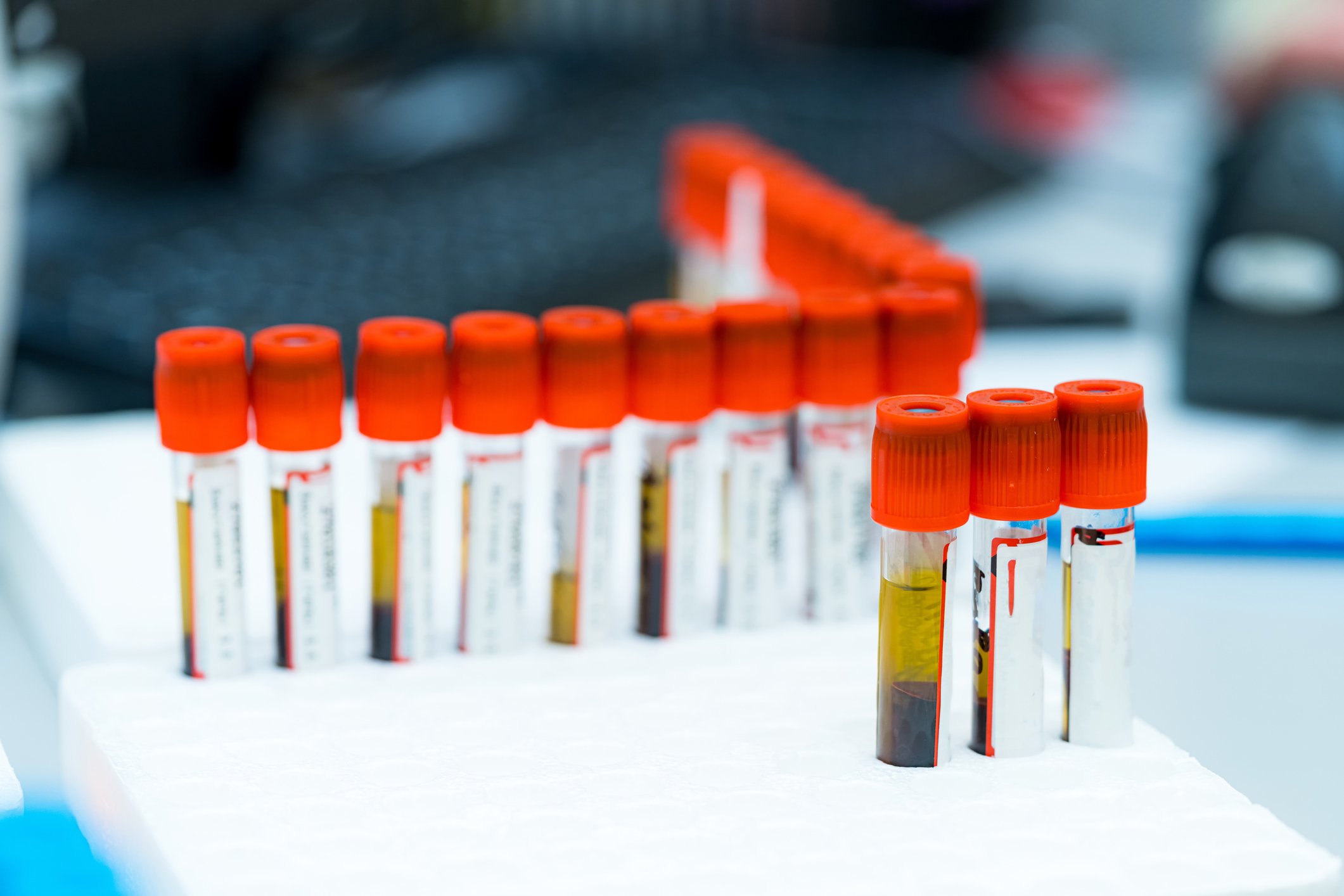 Rows of blood sample vials.